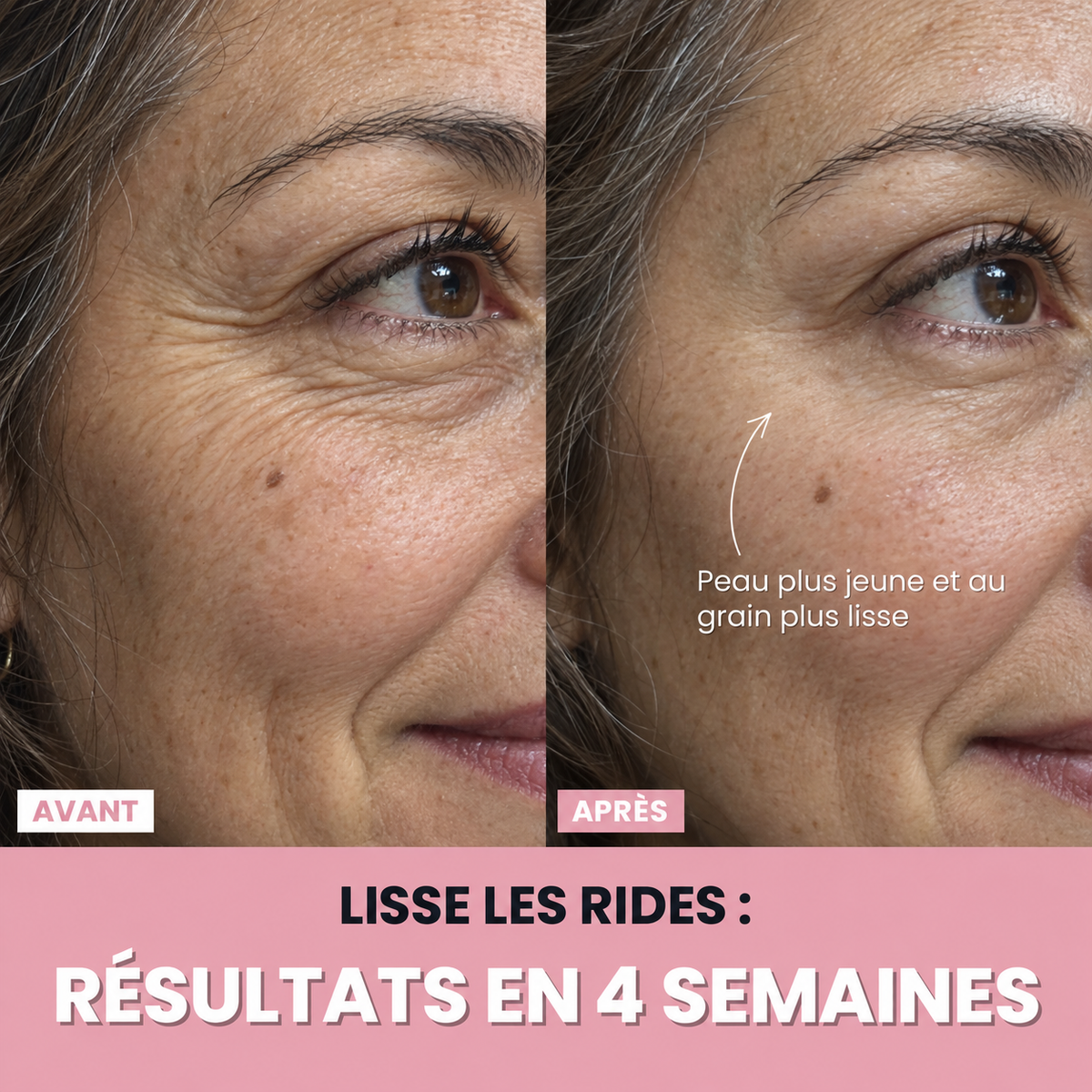 Aube™ : Sculpteur facial LED 7 en 1