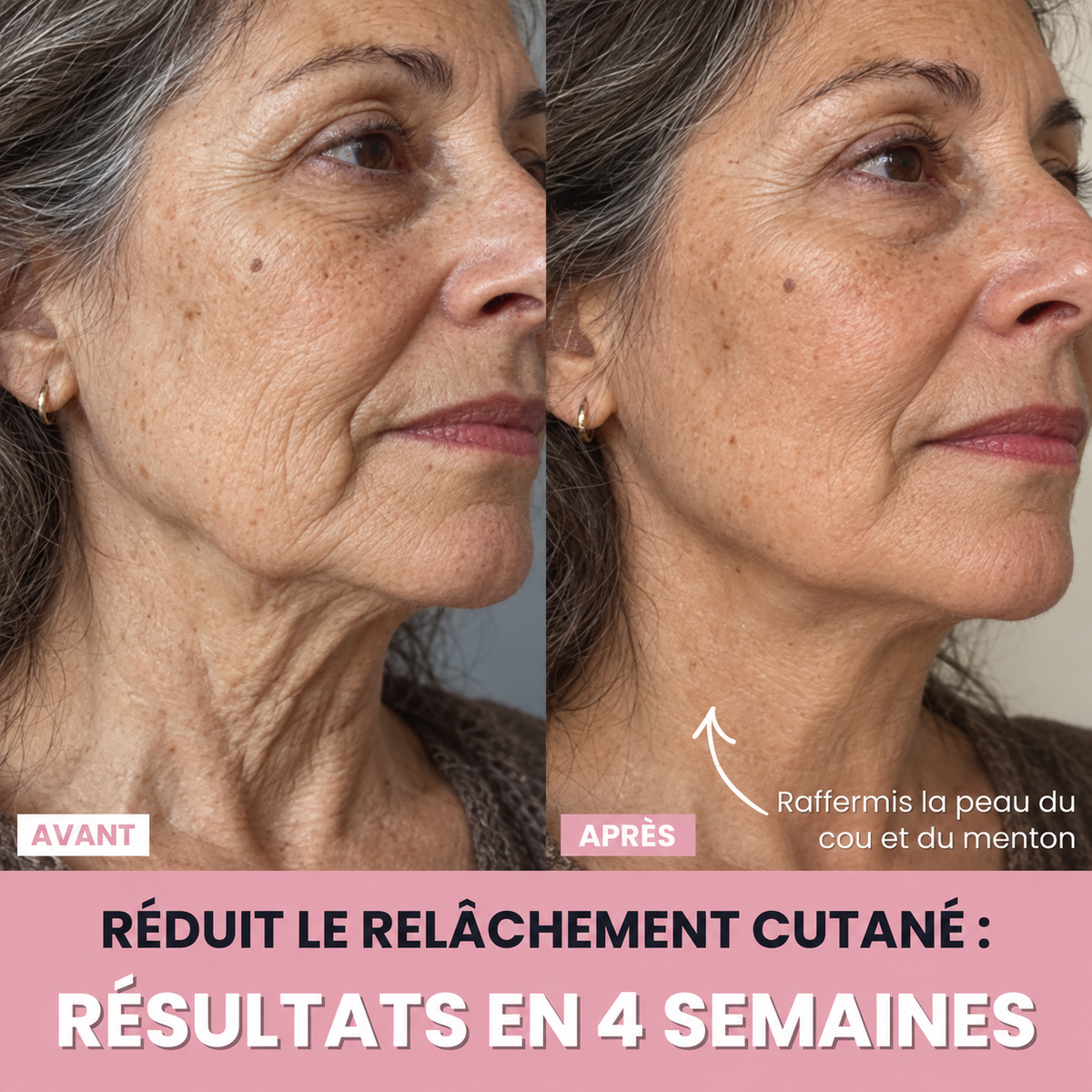 Aube™ : Sculpteur facial LED 7 en 1