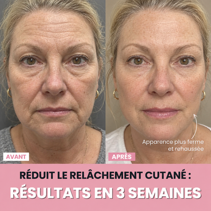 Aube™ : Sculpteur facial LED 7 en 1