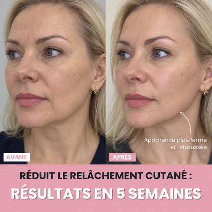 Aube™ : Sculpteur facial LED 7 en 1